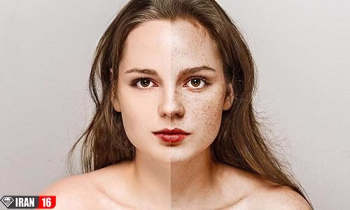 درمان خانگی کک و مک