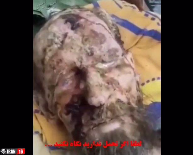 مردی که 10 روز زنده به گور شده بود (فیلم)