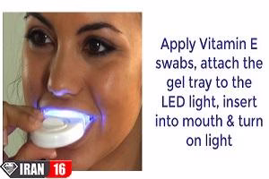 دستگاه سفید کننده و براق کننده دندان