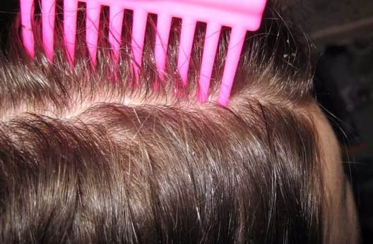 تعبیر خواب شپش از زبان یوسف پیامبر