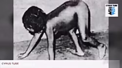 10 Humans who grow up with animals and grow up wild