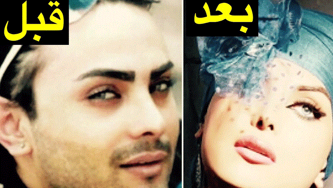 ناگفته های دو ترنس از تغییر جنسیت / ترنس ها را اذیت نکنید