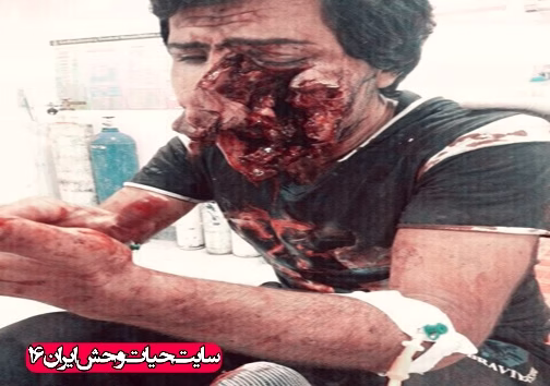 حمله خرس به انسان