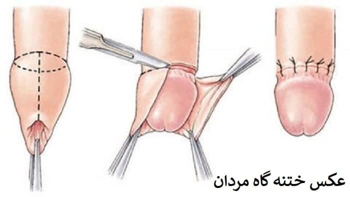 اندازه طبیعی آلت تناسلی مردان و اهمیت در رابطه جنسی + عکس اندازه ایده آل 1 ختنه گاه کیر